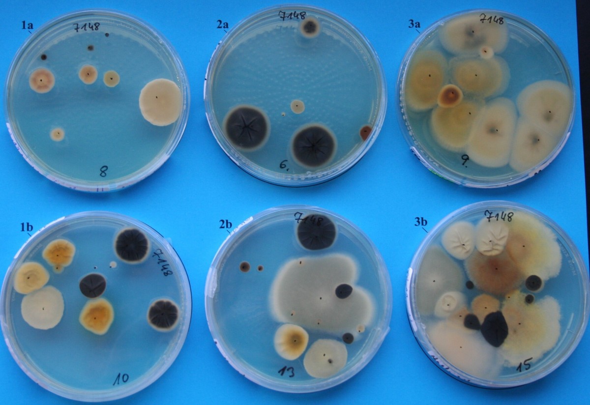 Kfz Luftproben auf Nährboden